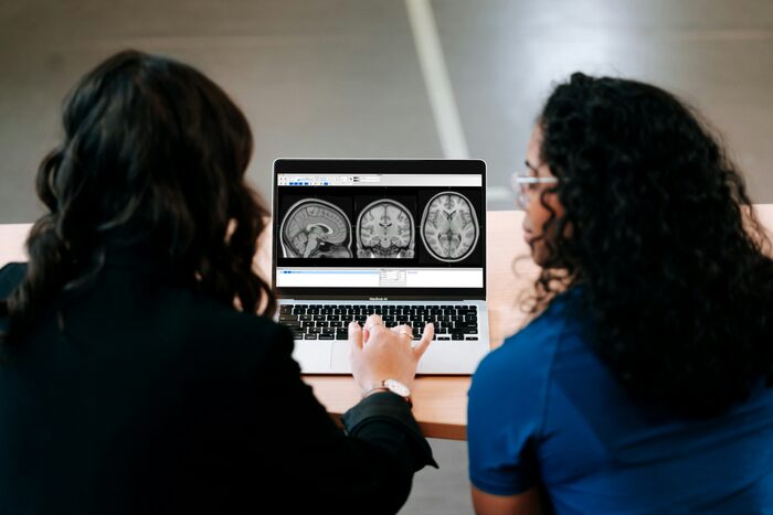 Researchers reviewing brain MRI scans